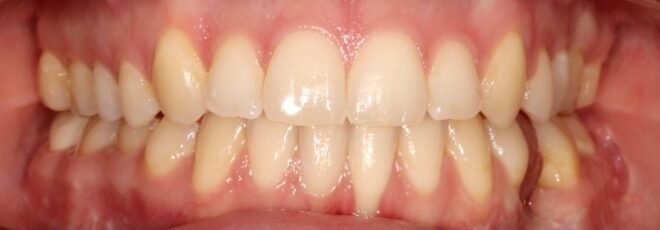 orthodontist coppell tx