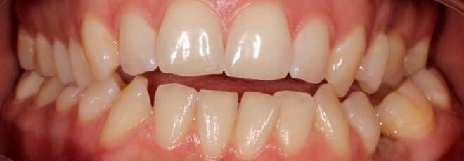 orthodontist coppell tx