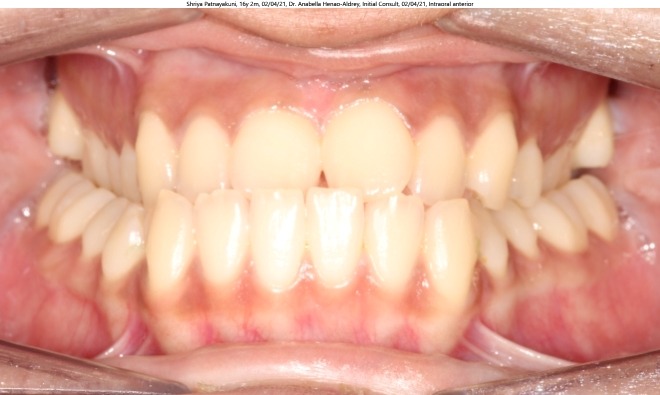 orthodontist coppell tx