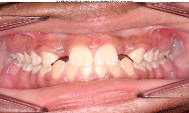 orthodontist coppell tx