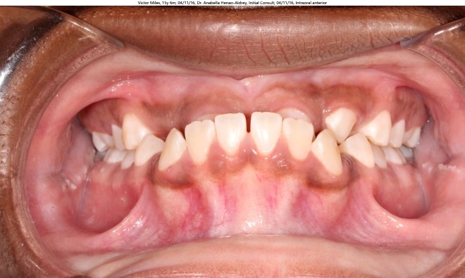 orthodontist coppell tx