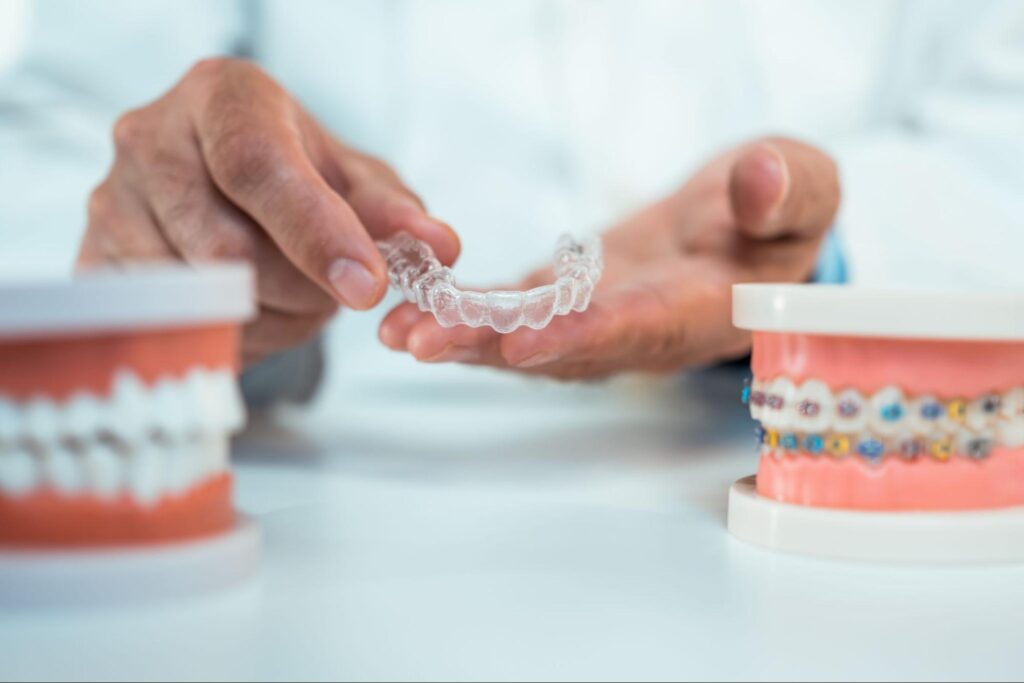 The Dangers of DIY Orthodontics