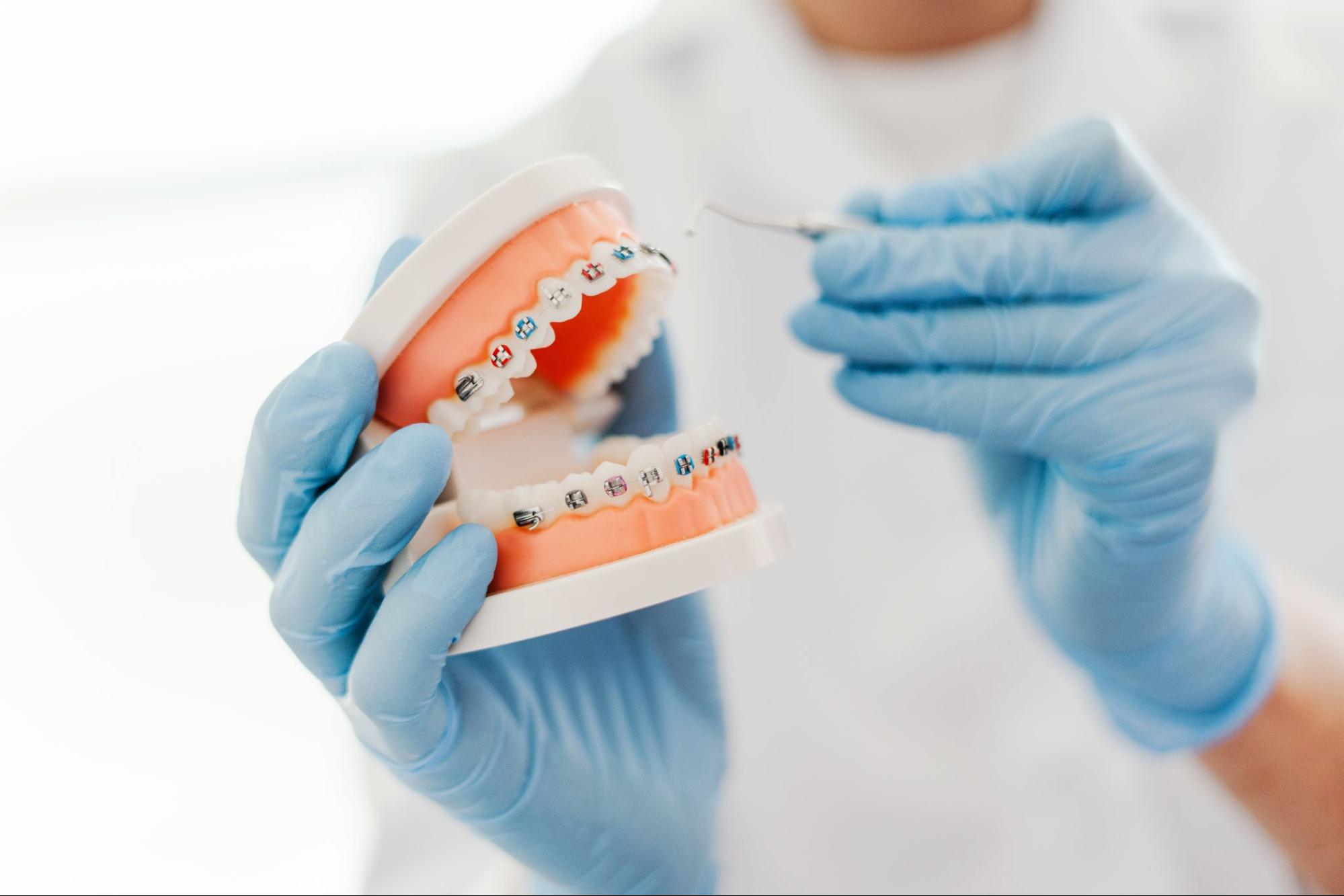 The Dangers of DIY Orthodontics