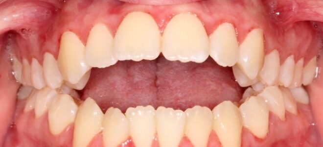 orthodontist coppell tx